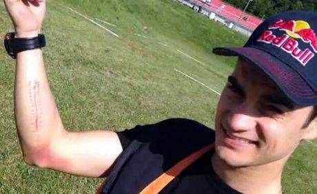 5-fakta-arm-pump-si-pembunuh-karier-pedrosa-ok1