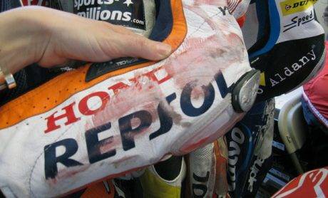 Alpinestars-Marquez-Elbow-thumb-620x375-58422