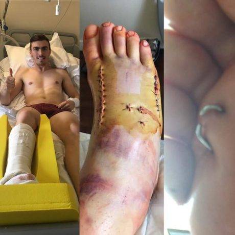 Loriz baz surgery